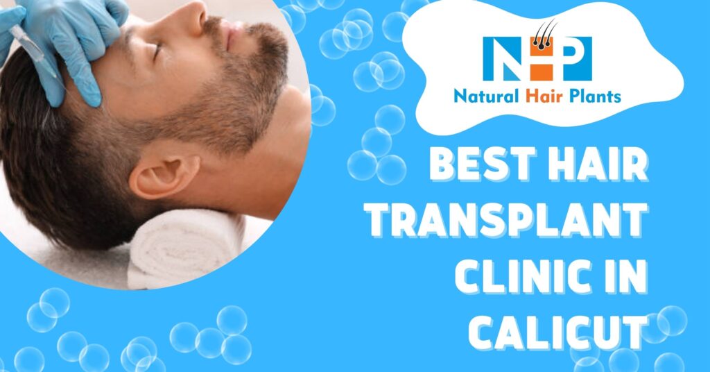 best-natural-hair-transplant-clinic-in-calicut-nhp-kozhikode